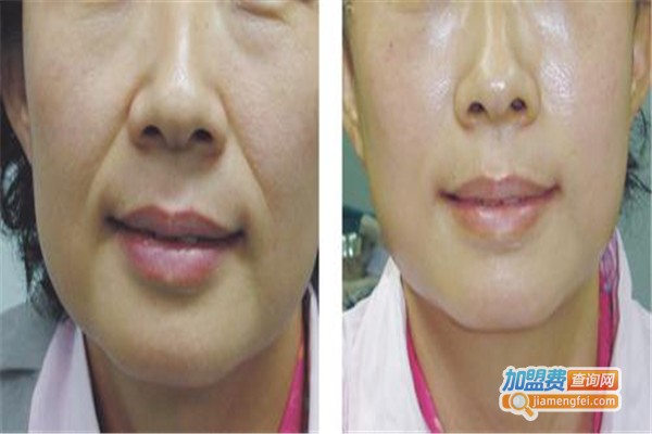 彩光嫩肤整形美容医院加盟费
