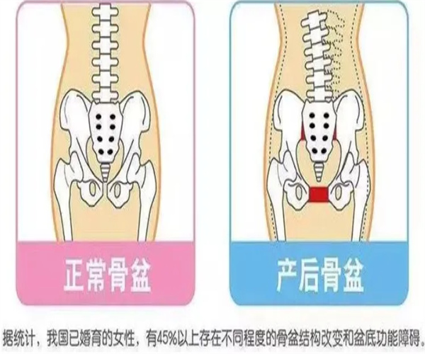 产后修复骨盆加盟费用