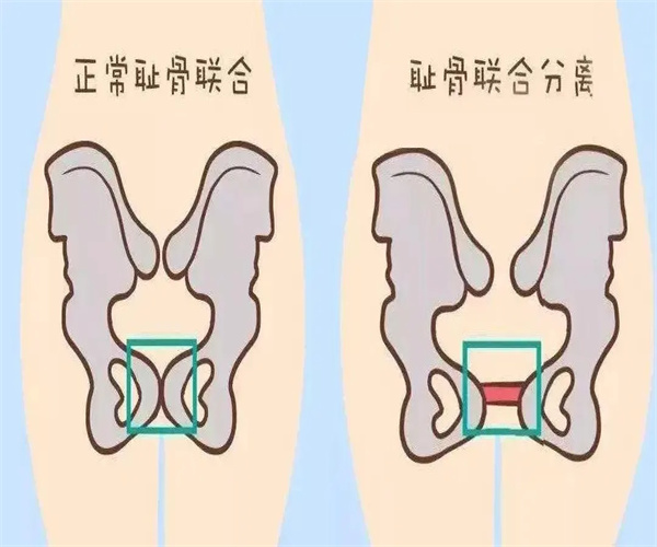 产后修复骨盆加盟费用