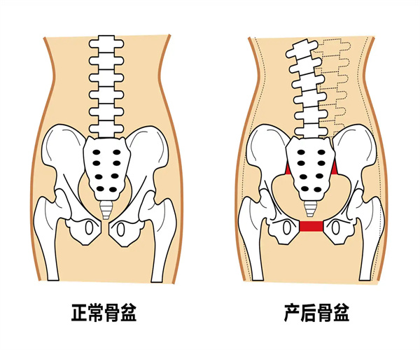 产后修复骨盆加盟费用