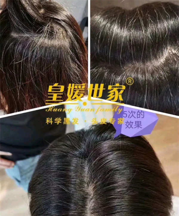 皇媛世家白转黑加盟费