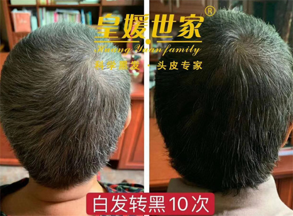 皇媛世家白转黑加盟费