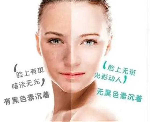 万黛摩颜祛斑加盟费