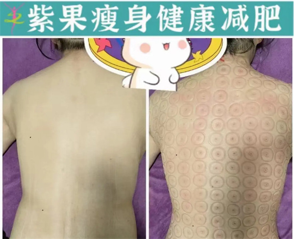 紫果瘦身加盟费