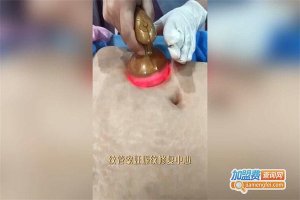 纹管家妊娠纹修复中心加盟费