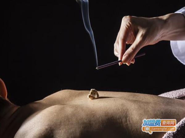 艾灸理疗馆连锁加盟加盟费用