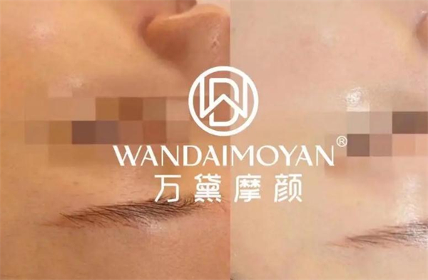 万黛摩颜祛斑加盟加盟费用