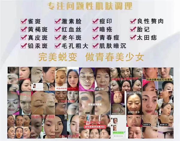 珂迪诗祛斑护肤品加盟加盟费用