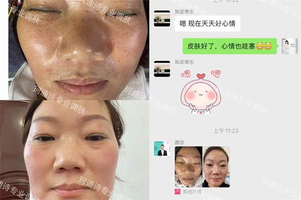 珂迪诗祛斑护肤品加盟加盟费用