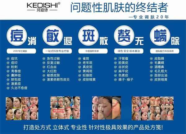 珂迪诗祛斑护肤品加盟加盟费用