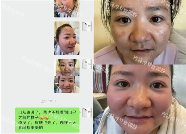 珂迪诗祛斑护肤品加盟加盟费用