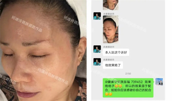 珂迪诗祛斑护肤品加盟加盟费用