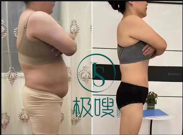 极嗖减肥加盟加盟费用