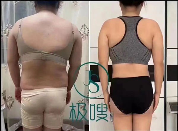 极嗖减肥加盟加盟费用