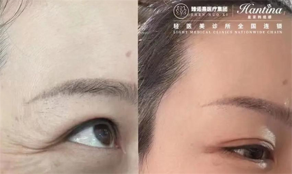 臻诺熹医疗美容加盟加盟费用