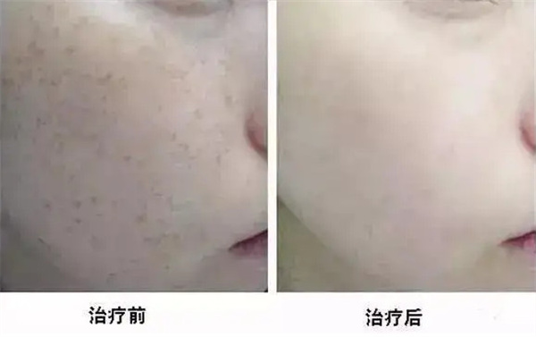 美诗颜泊草玉方祛斑加盟加盟费用