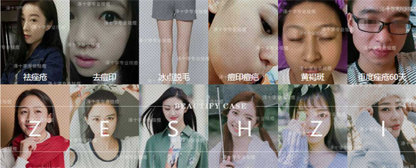 泽十字祛痘加盟加盟费用