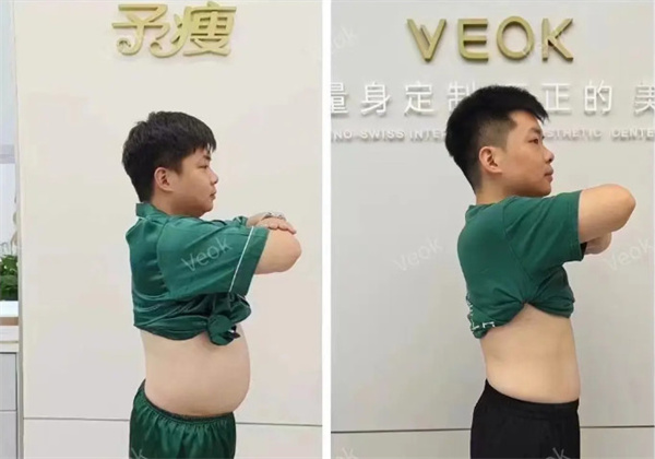 予瘦加盟加盟费用