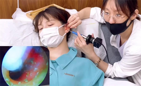 爱耳可视采耳加盟费