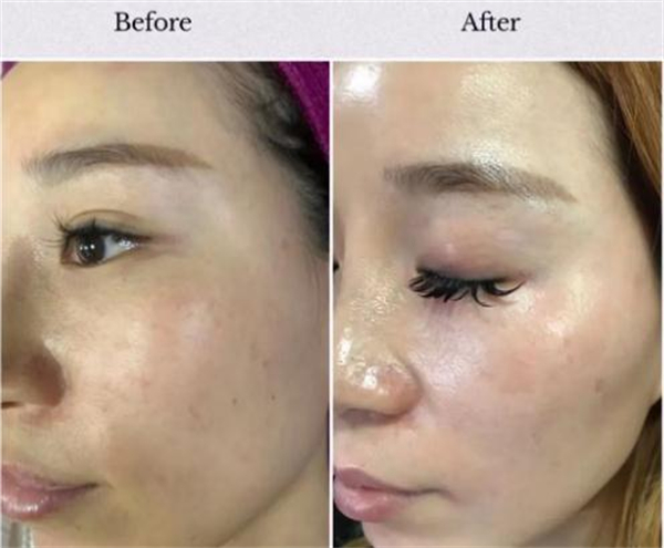 万黛摩颜祛斑加盟费