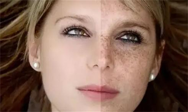 万黛摩颜祛斑加盟费