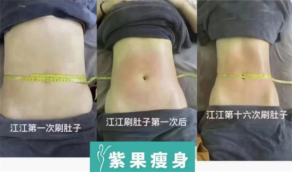 紫果瘦身加盟费